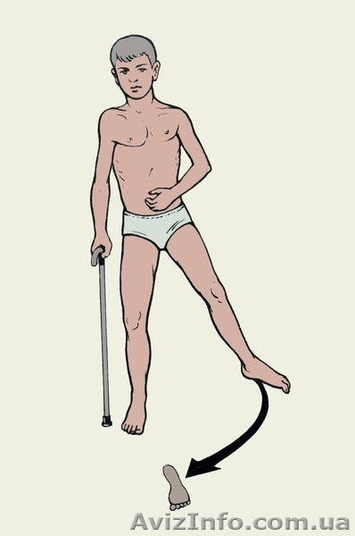 программа реабилитации, ЛФК, массаж - <ro>Изображение</ro><ru>Изображение</ru> #1, <ru>Объявление</ru> #804971