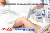 Эпил МедЭстет Центр Лазерной эпиляции Винницы - <ro>Изображение</ro><ru>Изображение</ru> #5, <ru>Объявление</ru> #1648147