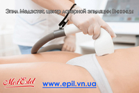 Эпил МедЭстет Центр Лазерной эпиляции Винницы - <ro>Изображение</ro><ru>Изображение</ru> #2, <ru>Объявление</ru> #1648147