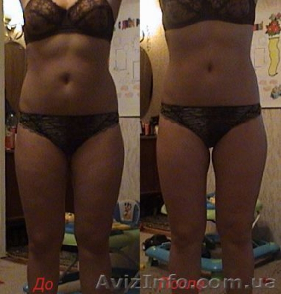 Центр красоты и здоровья - <ro>Изображение</ro><ru>Изображение</ru> #1, <ru>Объявление</ru> #384977