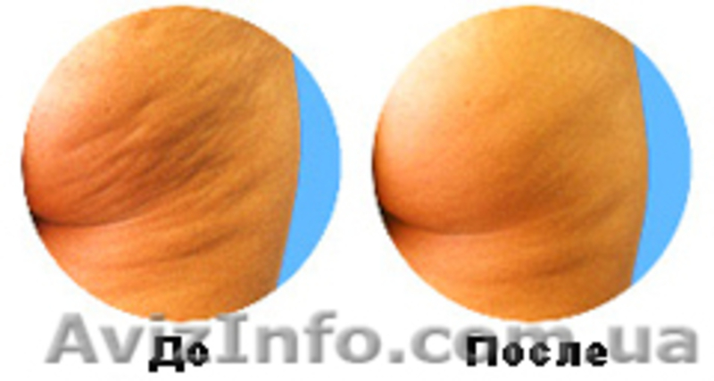 Центр красоты и здоровья - <ro>Изображение</ro><ru>Изображение</ru> #2, <ru>Объявление</ru> #384977