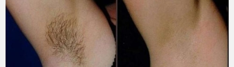 Майстер по шугарингу Винница - <ro>Изображение</ro><ru>Изображение</ru> #3, <ru>Объявление</ru> #1715774