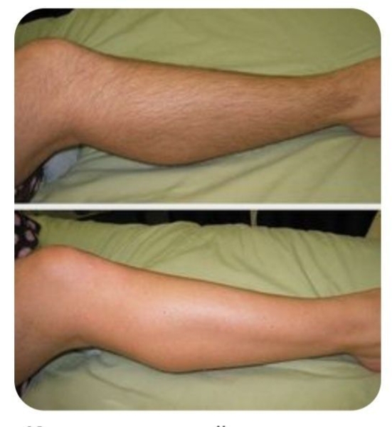 Майстер по шугарингу Винница - <ro>Изображение</ro><ru>Изображение</ru> #4, <ru>Объявление</ru> #1715774